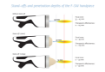 Kép INTELECT FOCAL SHOCKWAVE SET - CHATTANOOGA