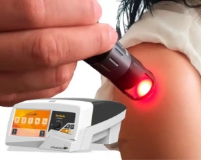 Kép a kategóriának Lézer